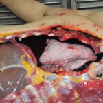 Stabbed woman in morgue