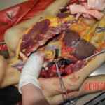 Stabbed woman in morgue