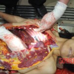 Stabbed woman in morgue