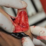 Chinese woman stabbed to death