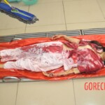 Stabbed woman in morgue