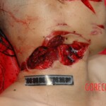 Autopsy of woman stabbed in neck