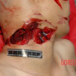 Autopsy of woman stabbed in neck