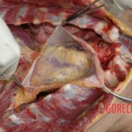 Autopsy of woman stabbed in neck