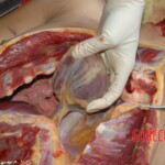 Autopsy of woman stabbed in neck