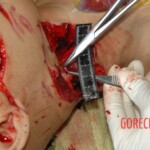 Autopsy of woman stabbed in neck