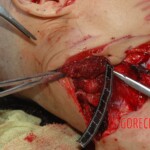 Autopsy of woman stabbed in neck