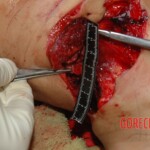 Autopsy of woman stabbed in neck