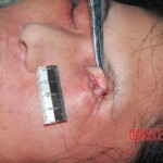 Victim of heart attack