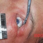 Victim of heart attack