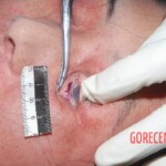 Victim of heart attack