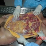 Victim of heart attack