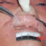 Victim of heart attack