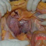 Victim of heart attack