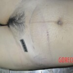 Female corpse in morgue