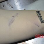 Female corpse in morgue