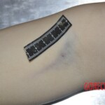 Female corpse in morgue