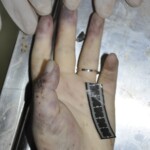 Female corpse in morgue