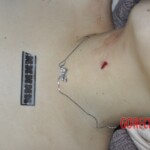 Female corpse in morgue