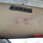 Female corpse in morgue