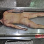 Dead Chinese woman