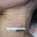 Chinese woman in morgue