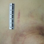 Chinese woman in morgue