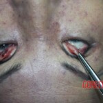 Chinese woman in morgue