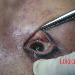 Chinese woman in morgue