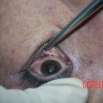 Chinese woman in morgue