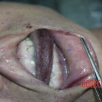 Chinese woman in morgue