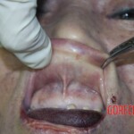 Chinese woman in morgue