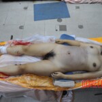 Chinese woman in morgue