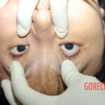 Chinese woman in morgue