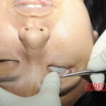 Chinese woman in morgue