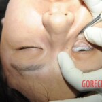 Chinese woman in morgue