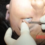 Chinese woman in morgue