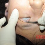 Chinese woman in morgue