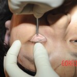 Chinese woman in morgue