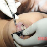 Chinese woman in morgue