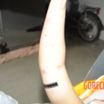 Chinese woman in morgue