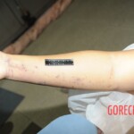 Chinese woman in morgue