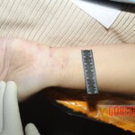 Chinese woman in morgue