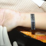 Chinese woman in morgue