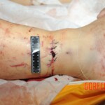 Chinese woman in morgue