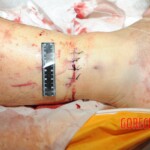 Chinese woman in morgue