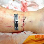 Chinese woman in morgue