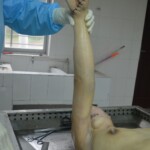 Chinese woman in morgue