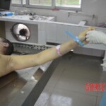 Chinese woman in morgue
