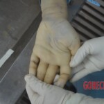 Chinese woman in morgue